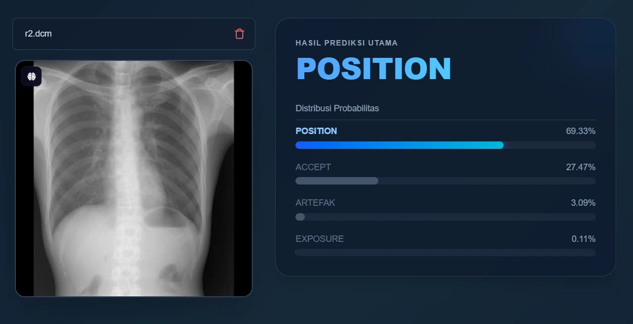 Thorax Analysis Illustration